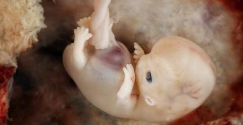Embrión de siete semanas. / lunar caustic