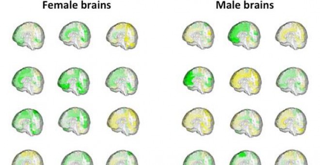 Diferentes volúmenes (verde=grande, amarillo=pequeño) de las regiones del cerebro en 42 adultos que muestran la coincidencia entre las formas de los cerebros de las mujeres y los cerebros de los hombres.