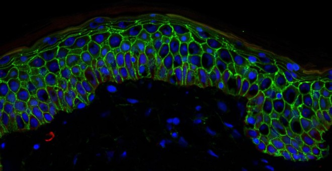 Corte de epidermis humana al microscopio (células en verde y sus núcleos en azul). EUROSTEMCELL