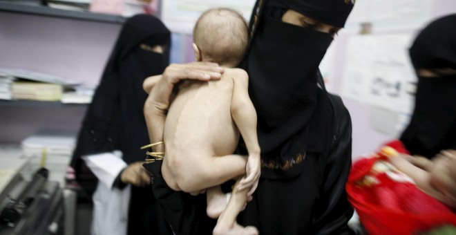 A woman holds her malnourished child at a malnutrition intensive care unit in Yemen's capital Sanaa April 6, 2016. REUTERS/Khaled Abdullah