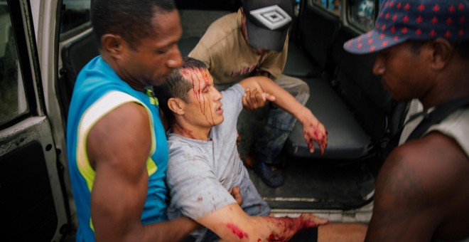 Un refugiado herido en el centro de detención de la Isla de Manus es llevado en brazos tras ser herido en un ataque de un grupo de hombres de Papúa Nueva Guinea. REUTERS