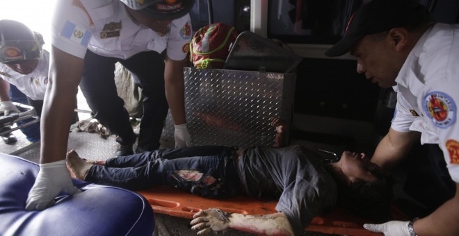 Una menor es ingresada en la unidad de emergencias del hospital San Juan de Dios, en Ciudad de Guatemala (Guatemala), tras el incendio en un centro de menores de Guatemala. EFE/Danilo Ramirez