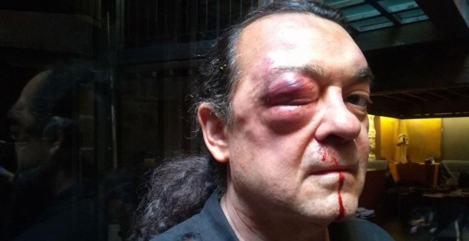 El rostro del líder de Imagina Podemos en Castilla-La Mancha, Fernando Barredo, después de haber sido agredido brutalmente./TWITTER