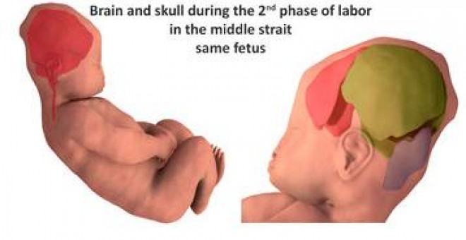 Reconstrucción tridimensional de los huesos craneales antes del parto y durante la segunda parte del mismo. / Ami et al