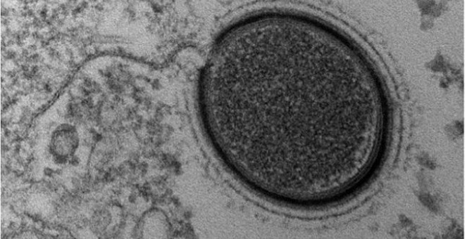 Descubren un virus gigante desconocido en el suelo congelado de Siberia. /PNAS-CNRS