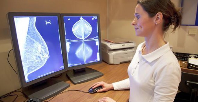Las mujeres con cáncer de mama que utilizan suplementos dietéticos y terapias alternativas son menos propensas a iniciar tratamientos de quimioterapia. / Fotolia