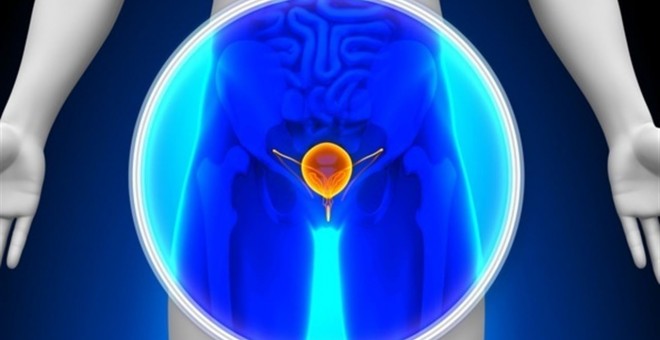 Un medicamento muestra mejoras en el tratamiento del cáncer de vejiga. /GETTY