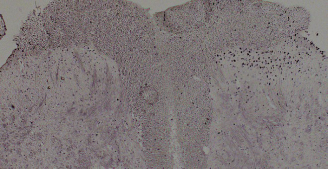 Imagen al microscopio de un corte de médula espinal. En él pueden verse las células que están activadas (en negro en la mitad derecha de la imagen). / Cortesía de Jose Vicente Torre