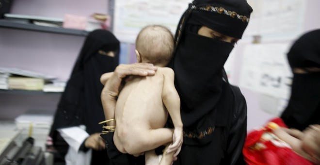 Una dona té en braços un nen que pateix desnutrició. REUTERS / Khaled Abdulah