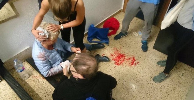 Una mujer herida tras una carga policial