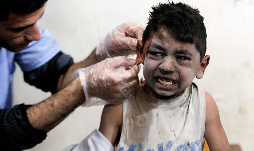 Un niño herido recibe asistencia médica en un hospital de campaña. El pequeño resultó herido en lo que los activistas dijeron que eran ataques aéreos de las fuerzas leales a Al-Assad, en Siria. / MOHAMMED BADRA (REUTERS)