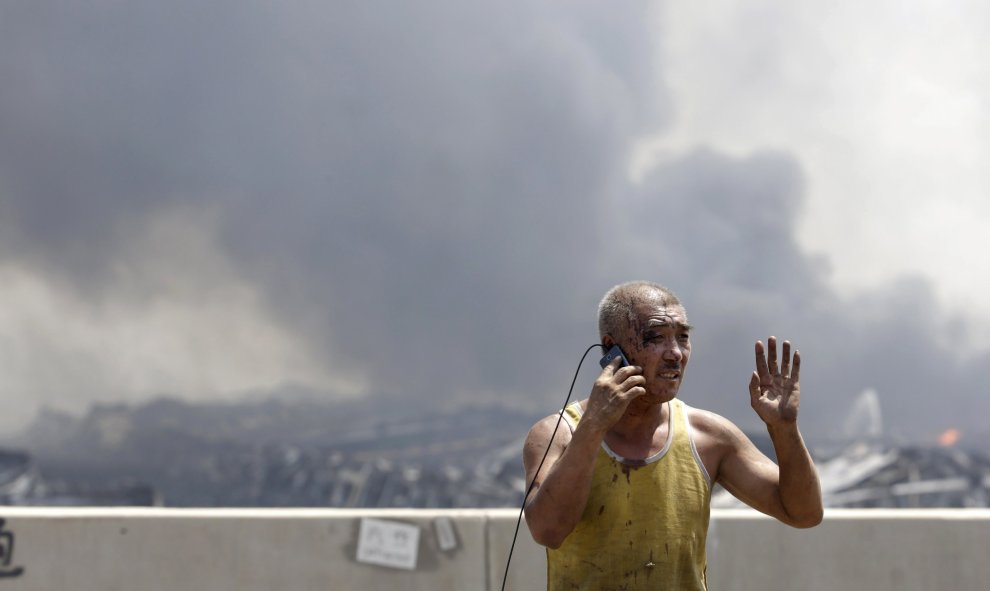Un hombre herido habla por su teléfono móvil. De fondo, la columna de humo que ha dejado el incendio posterior a la explosión. REUTERS