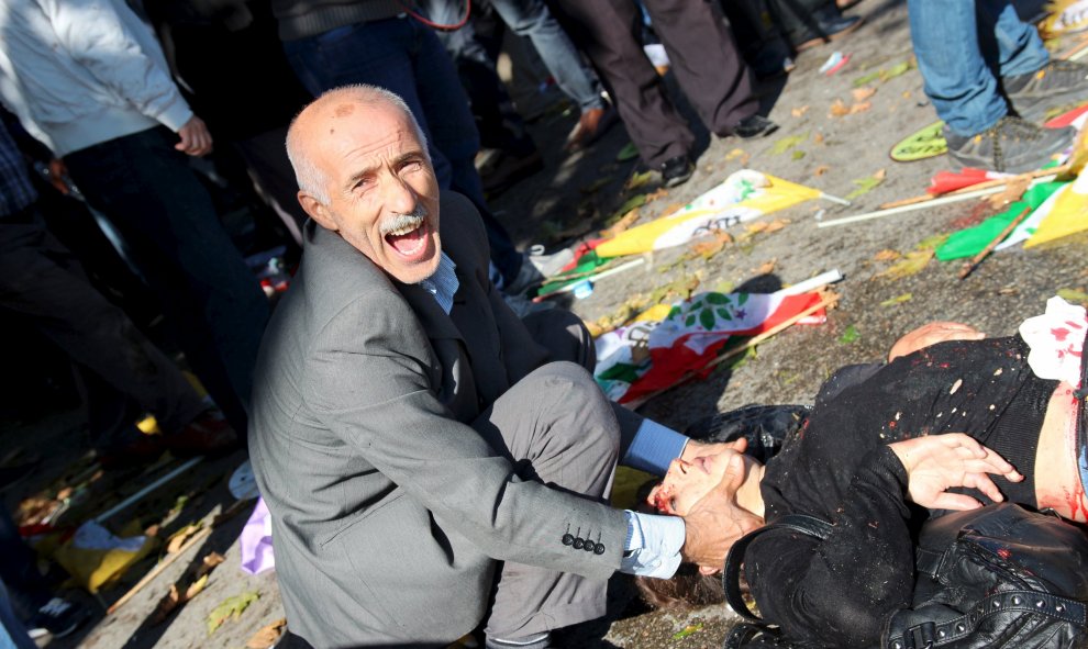 Un hombre pide ayuda para un herido por las explosiones en el centro de Ankara durante una marcha pro-kurda. REUTERS/Tumay Berkin