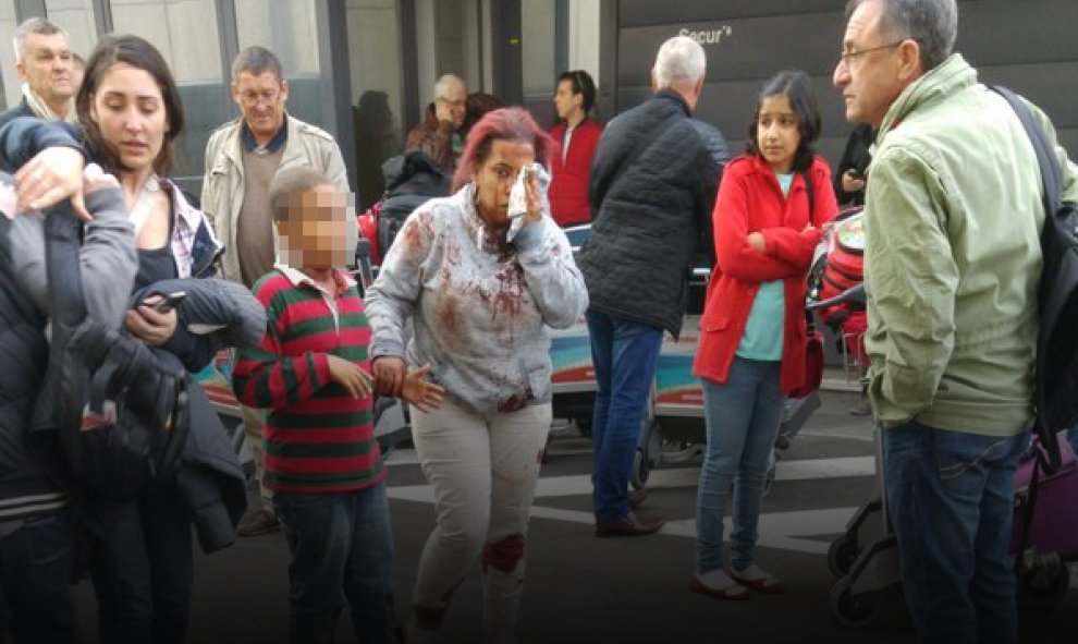 Heridos en el aeropuerto.- EUROPA PRESS