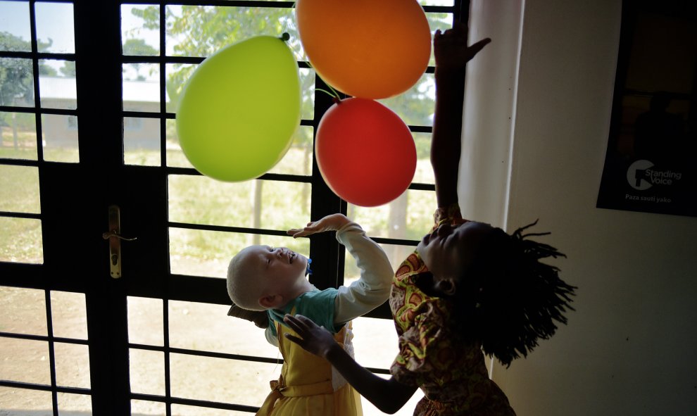 Una niña albina juega con globos en Ukerewe, en el Lago Victoria durante el Día Internacional de Sensibilización sobre el Albinismo. CARL DE SOUZA / AFP