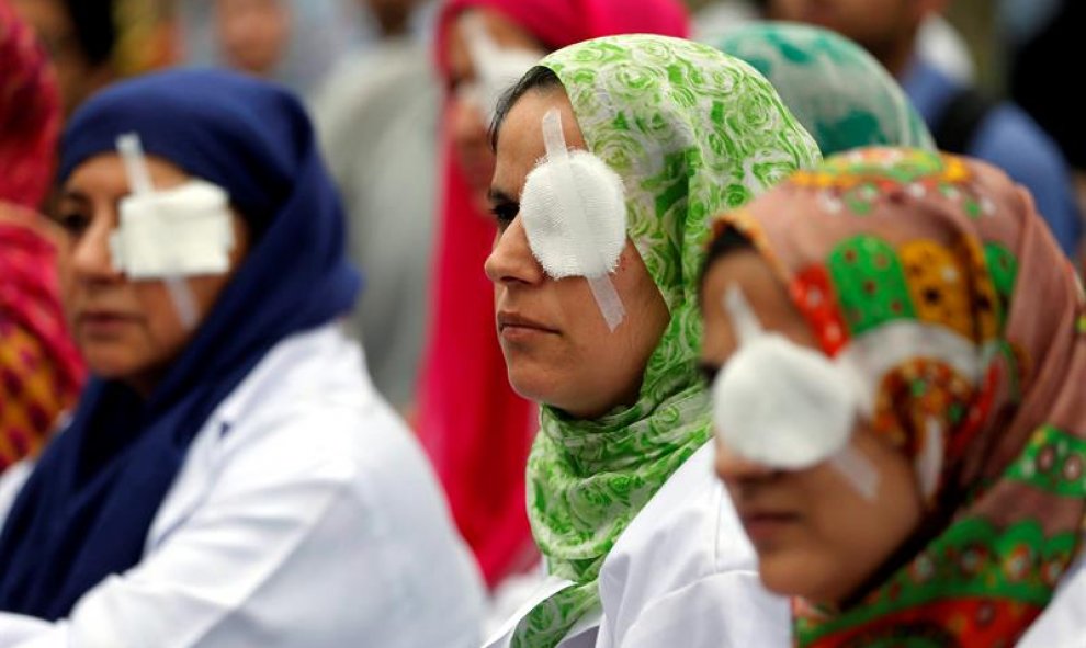 Médicos cachemiras se tapan un ojo en solidaridad con los musulmanes cachemiros que se han quedado ciegos debido a los perdigones durante los disturbios registrados este verano en la región, en Srinagar, capital estival de la región cachemira bajo adminis