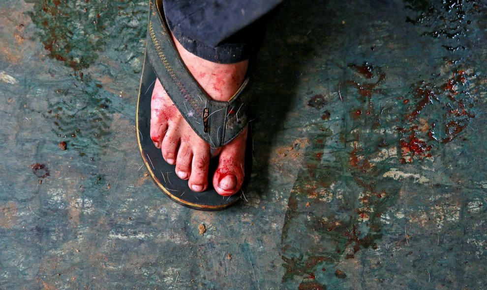 El pie de un carnicero, cubierto de pelo y sangre después del sacrificio de una cabra durante Eid al -Adha en Delhi, India. REUTERS/Cathal McNaughton