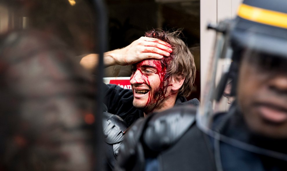 Vista de un manifestante herido durante una protesta contra la nueva reforma laboral en París.- EFE/Etienne Laurent