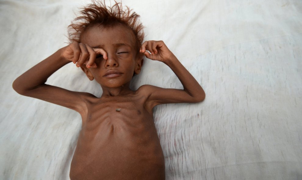 La hambruna acecha Yemen. Hospital de al-Tuhaita, en la provincia del Mar Rojo de Hodaida, Yemen. REUTERS / Abduljabbar Zeyad