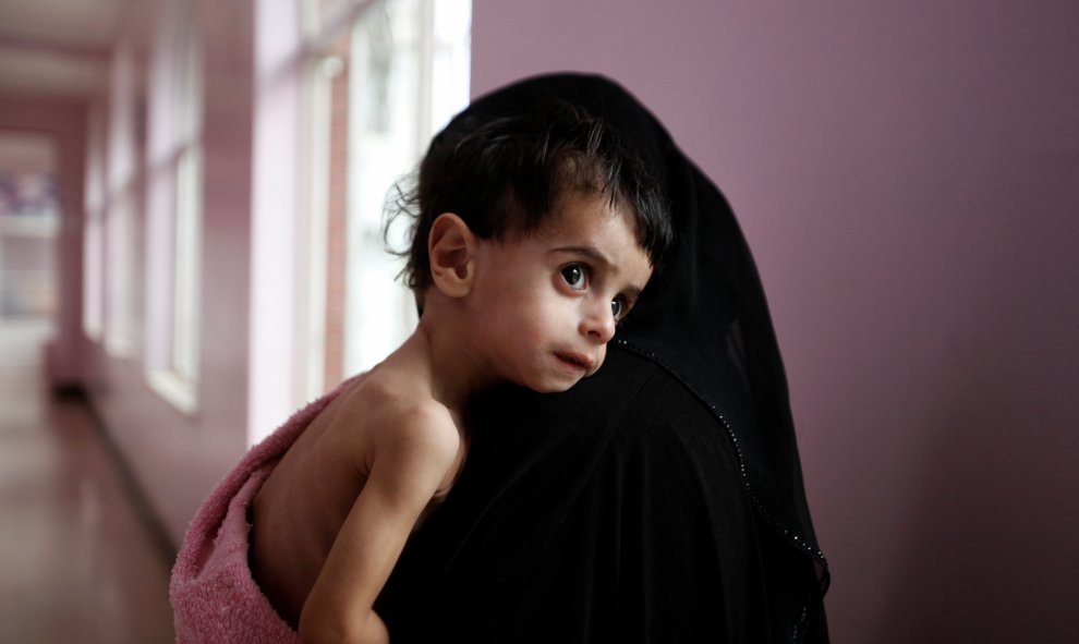 Una mujer sostiene a su niño desnutrido en la unidad de cuidados intensivos de un hospital en Sanaa. REUTERS / Khaled Abdullah