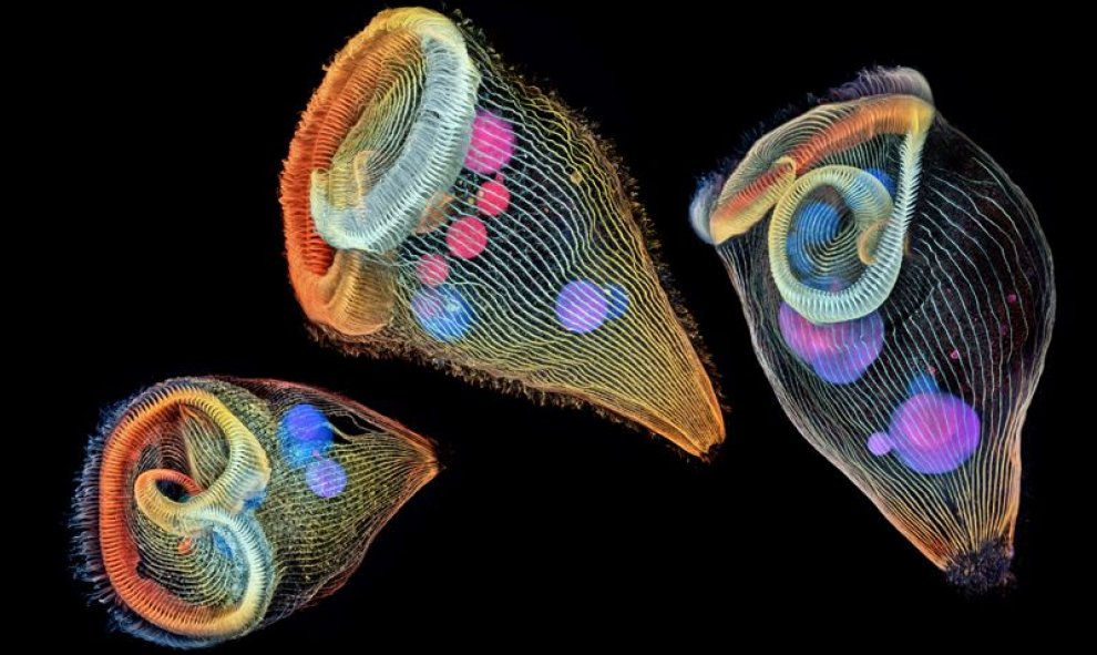 Un grupo de protozoos de agua dulce unicelulares llamado 'Stentors'. Dr. Igor Siwanowicz