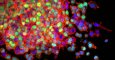 Células de cáncer de pulmón en proceso de metástasis, invadiendo los tejidos circundantes. / National Cancer Institute/Winship Cancer Institute of Emory University