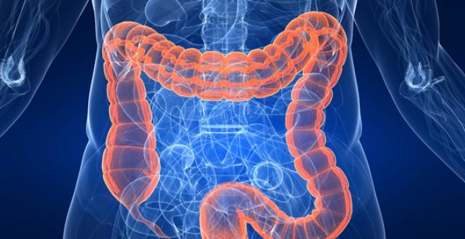 El cáncer de colon es de los más comunes en España, con 41.000 nuevos casos anuales