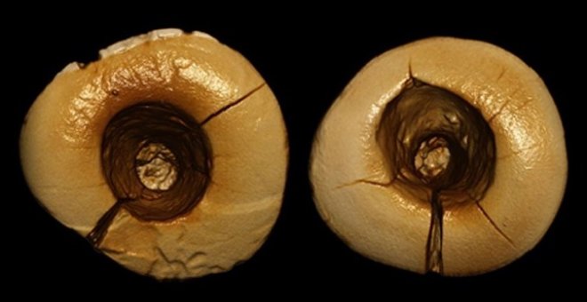 Imagen de los dos empastes dentales encontrados. AMERICAN JOURNAL OF PHYSICAL ANTHROPOLOGY (2017)