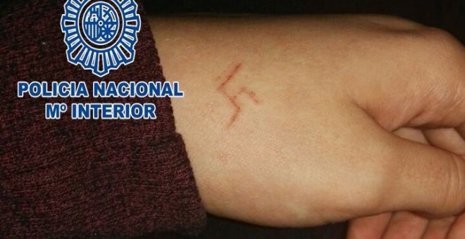 Imagen de la mano de la joven agredida. POLICÍA NACIONAL