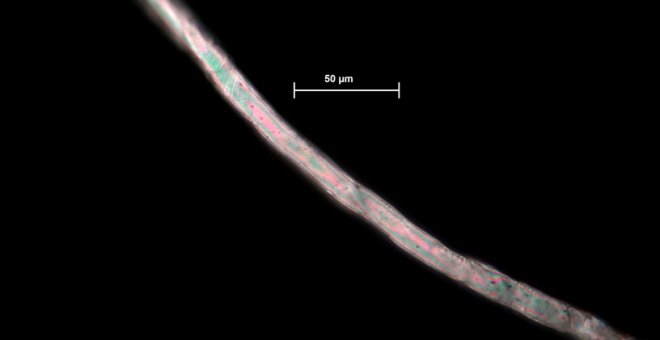 Microfibra de poliéster obtenida en los fondos marinos del océano Atlántico en un estudio similar. | Lucy Woodall / Museo de Historia Natural de Londres