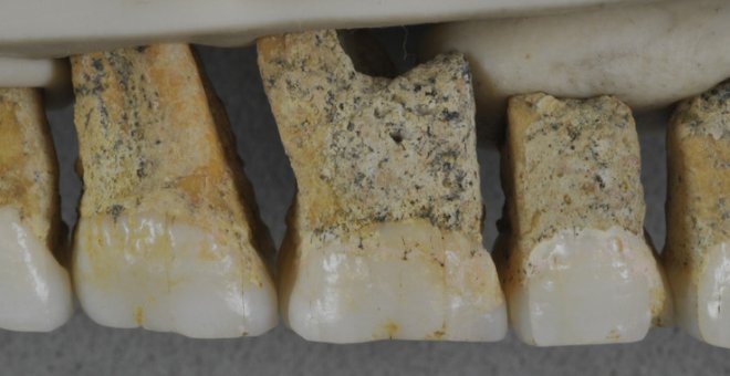Dentadura superior derecha de Homo luzonensis | Callao Cave Archaelogy Projet