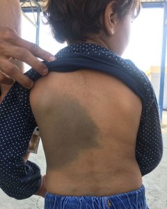 Un niño de cinco años herido tras caerse al suelo por un empujón de un policía croata. - NO NAME KITCHEN