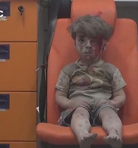 Omar Daqneesh, niño sirio superviviente de un bombardeo, se ha convertido en la imagen de la guerra siria/TWITTER