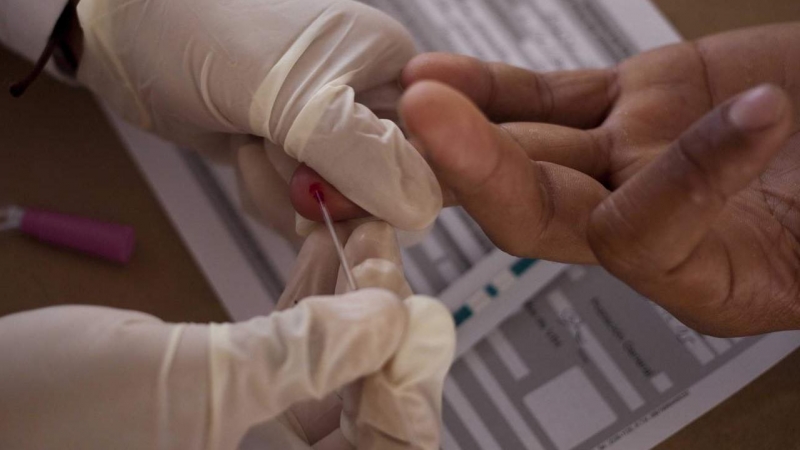 Detalle de la mano de hombre que se realiza la prueba del VIH | EFE/Archivo