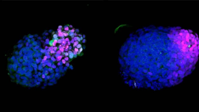 Gastruloide humano en crecimiento. 24h (izquierda), 48h (centro) y 72h (derecha) después de la agregación de células madre embrionarias (ESC). El azul marca el ADN, el magenta las células neurales (SOX2) y el verde las células mesodérmicas (BRA). / SINC -
