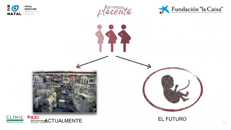 Infografía del proyecto de la placenta artificial