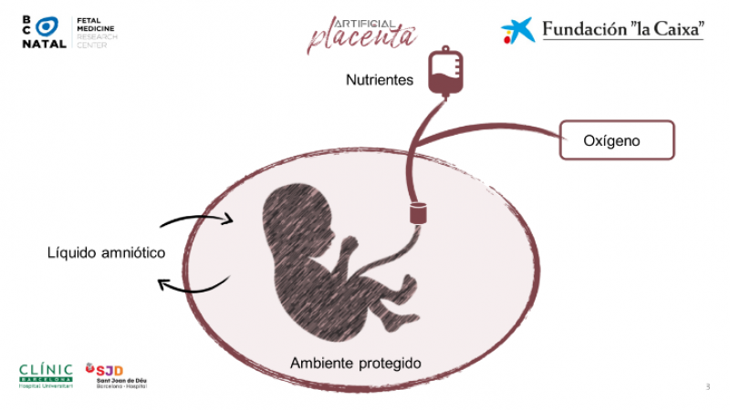 Infografía de la placenta artificial