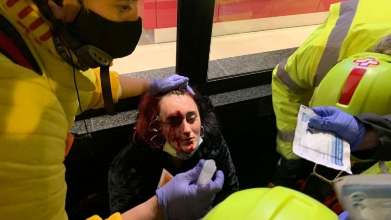 Foto de la mujer herida por una bala foam en la protesta por la encarcelación de Pablo Hasél.