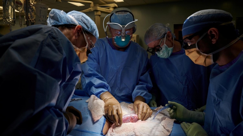 Fotografía de los investigadores estudiando el riñón de cerdo en la operación.