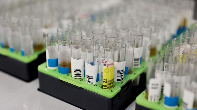Probetas de pruebas PCR en el Laboratorio de Microbiología del Hospital público Gregorio Marañón, a 31 de mayo de 2022, en Madrid (España). El centro hospitalario, junto a otros cuatro en la región, ha comenzado a realizar pruebas PCR para la viruela del