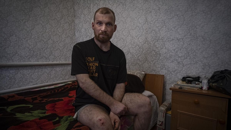 Alexander Ogorodnik, de 29 años y diagnosticado con un tumor cerebral, posa en su habitación en el sur de la provincia de Járkiv, donde recibe a 'Público'