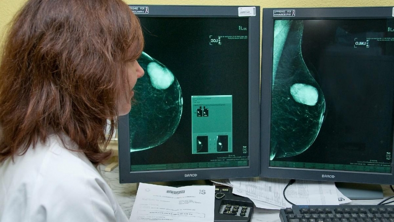 El Gobierno regional destinará 23 millones a la prevención del cáncer de mama en los próximos cuatro años