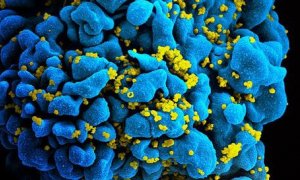 Partículas de VIH infectando a un linfocito T. / National Institutes of Health (NIH).
