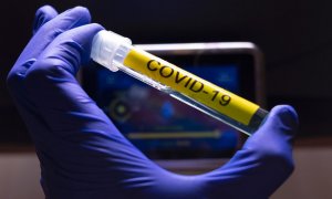 Neumólogos avisan de que España puede enfrentarse a un segundo brote "significativo" de COVID-19