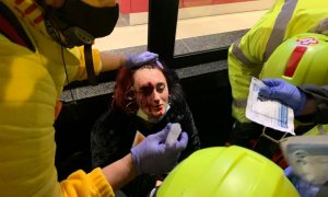 Foto de la mujer herida por una bala foam en la protesta por la encarcelación de Pablo Hasél.