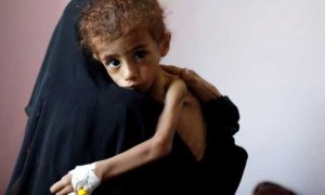 Ocho mil mujeres embarazadas y más de cien mil bebés mueren cada año en Yemen