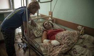 Nastia Kuzyk, de 20 años, en un hospital de Kiev donde le fue amputada una pierna tras un bombardeo ruso en su casa, en la ciudad de Chernígov, Ucrania.