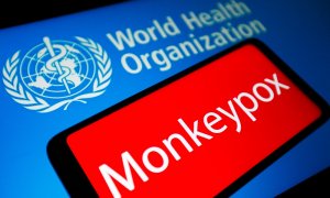 La palabra Monkeypox se ve en la pantalla de un teléfono inteligente y el logotipo de la Organización Mundial de la Salud (OMS) en el fondo.