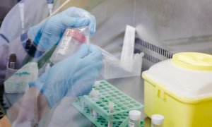 Una enfermera sostiene una de las pruebas de análisis para la viruela del mono, en el Hospital Ramón y Cajal, a 30 de mayo de 2022, en Madrid (España).