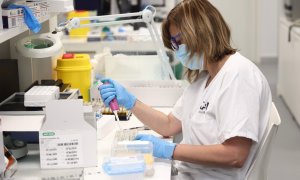 31/05/2022-Una técnico de laboratorio trabaja con pruebas PCR para detectar la viruela del mono en el Laboratorio de Microbiología del Hospital público Gregorio Marañón, a 31 de mayo, en Madrid